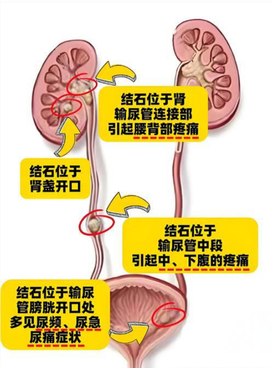 图片11.png 图片11.png